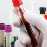 How Timing and Blood Sample Decay Can Be Used As an Atlanta DUI Defense Tool
